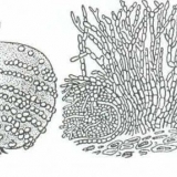 Trulež voća - mjere liječenja i suzbijanja monilioze na stablu jabu...